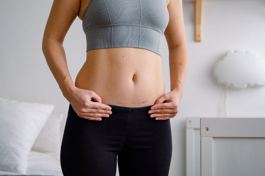 Bending After a C-Section