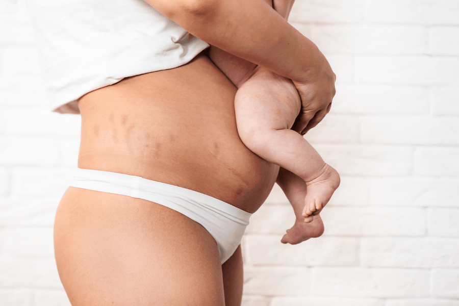 A mother with a postpartum belly, holding a baby in her arms