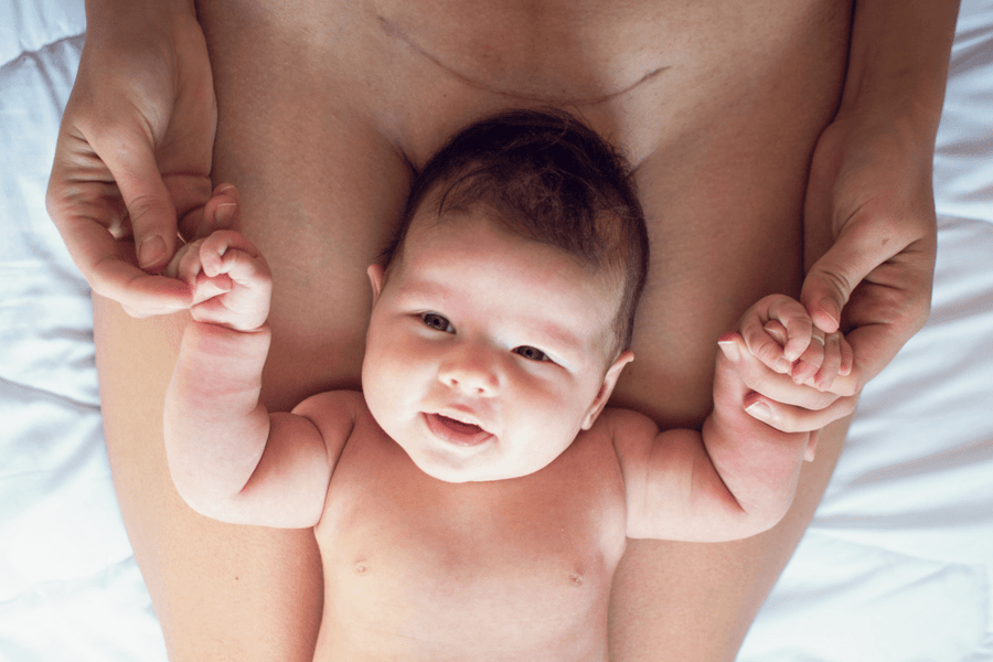 A joyful and smiling baby lying on top of their mother's C-section scar