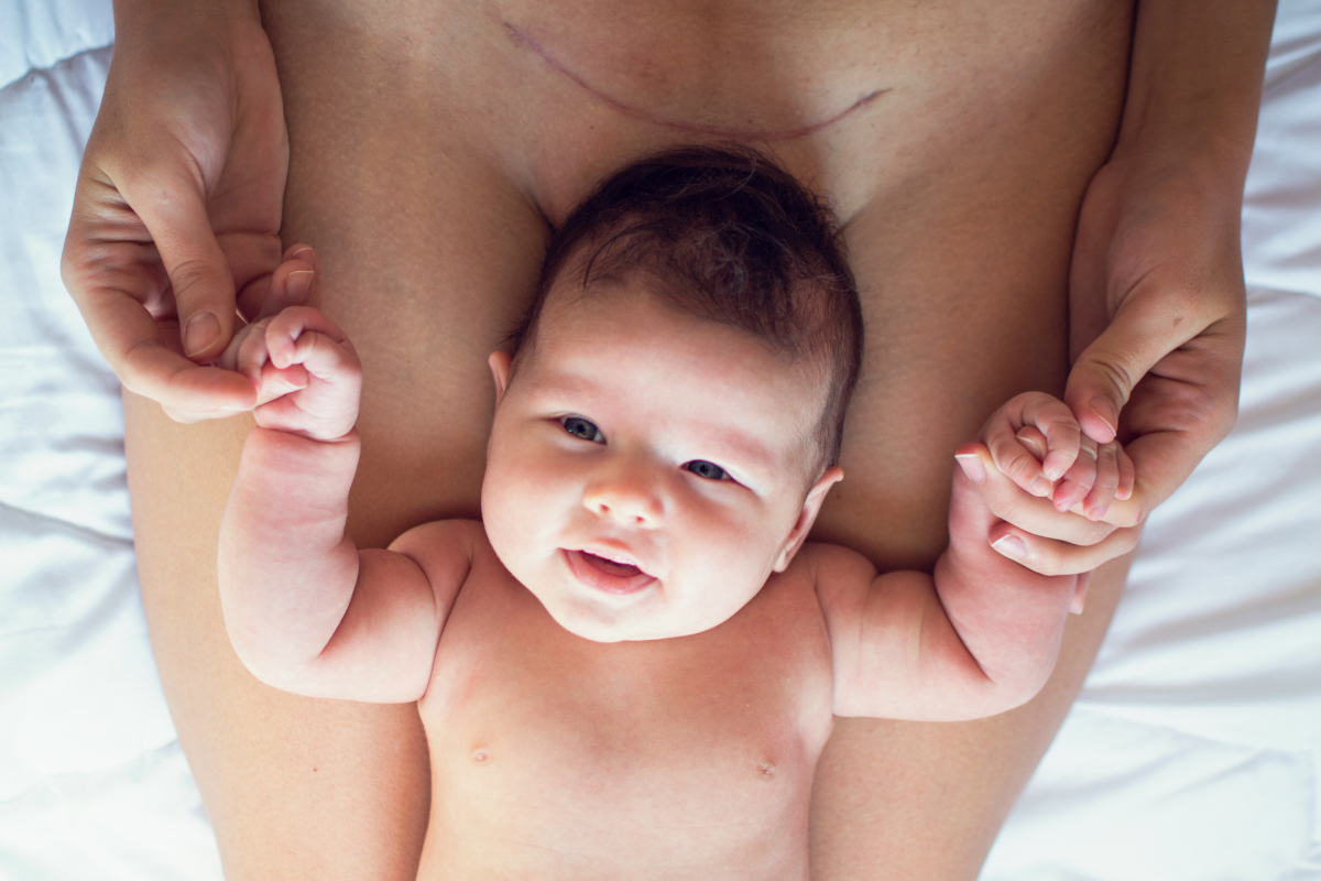 A joyful and smiling baby lying on top of their mother's C-section scar