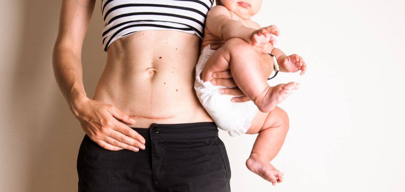 a mother holding baby checking diastasis recti