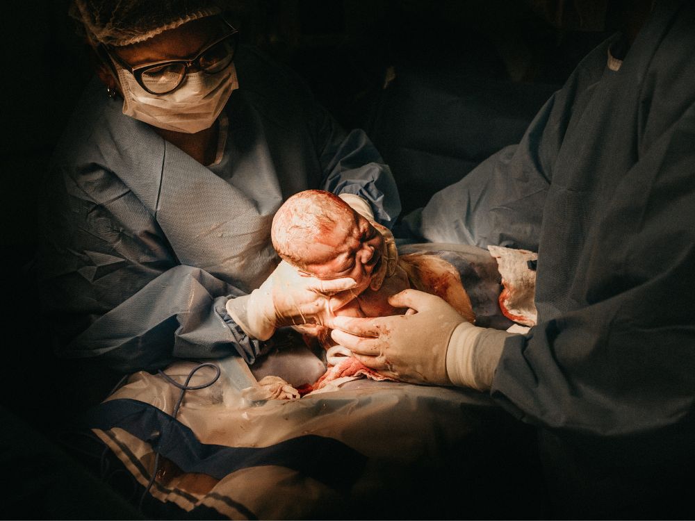 Doctors in hospital gowns holding a newborn baby while C-section delivery