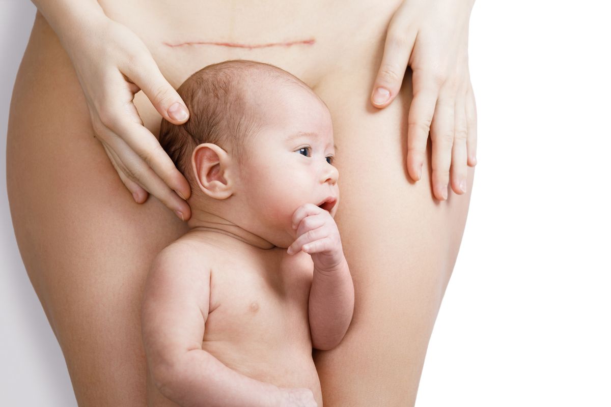 Celebrating C-Section Awareness Month: 10 Key Questions and Expert Insights